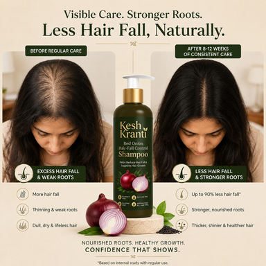 Reduce Hair Fall Naturally with Kesh Kranti Onion Shampoo
