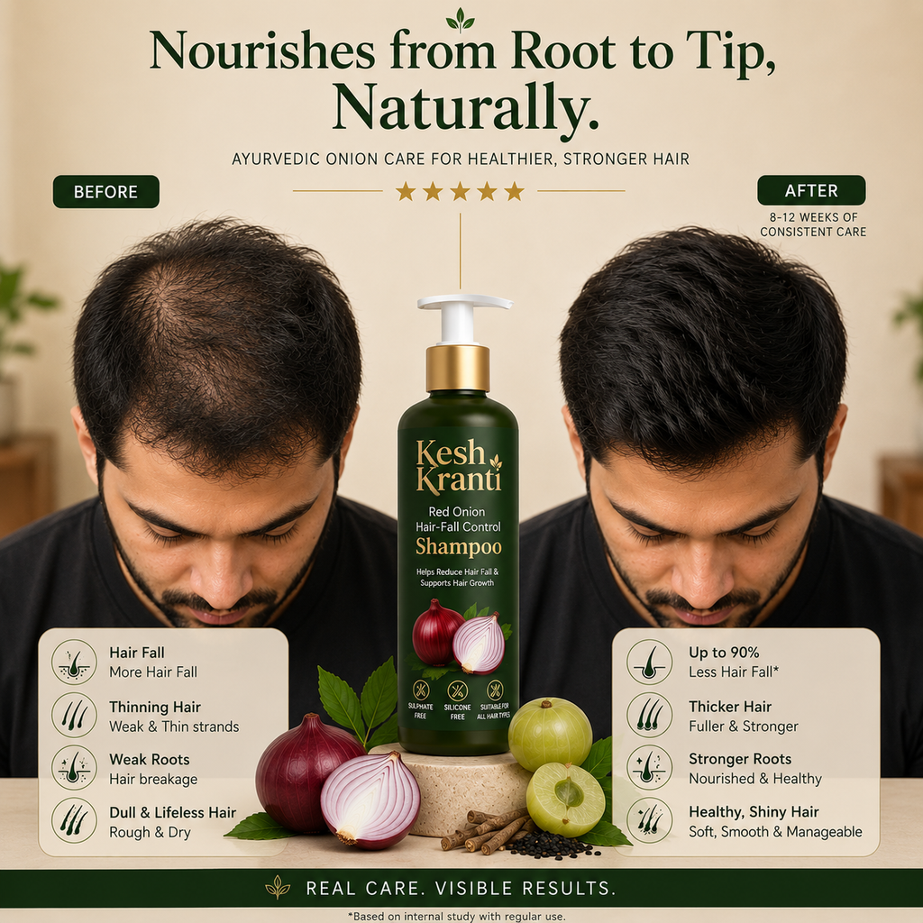 Reduce Hair Fall Naturally with Kesh Kranti Onion Shampoo