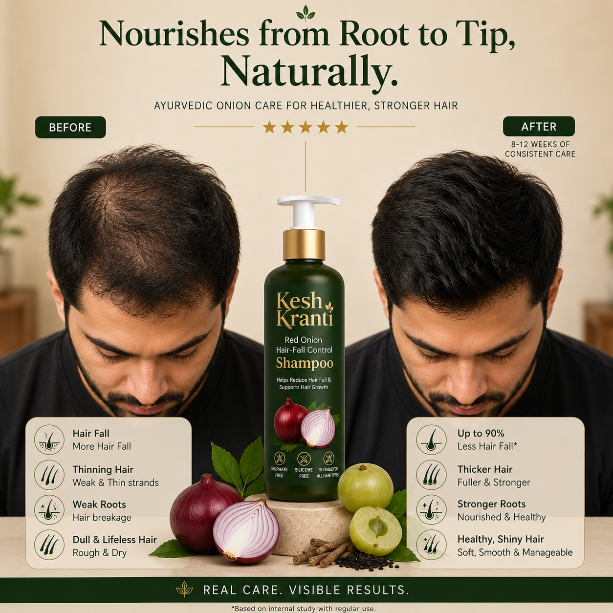 Reduce Hair Fall Naturally with Kesh Kranti Onion Shampoo